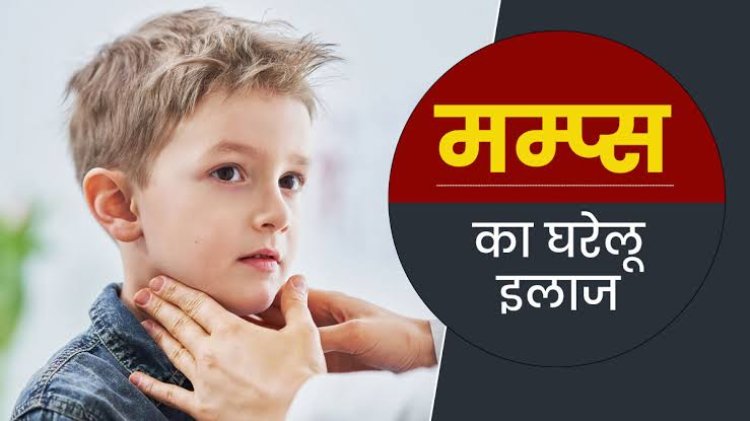 बलिया जिले में तेज़ी से पकड़ रहा गलसुआ (Mumps) छोटे बच्चों में दिख रहे लक्षण