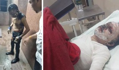चौंकाने वाला अपराध: ठक्कर बाजार बस स्टैंड के शौचालय में 'हैप्पी होली' कहते हुए पेट्रोल डालकर जलाए गए कर्मचारी की मौत