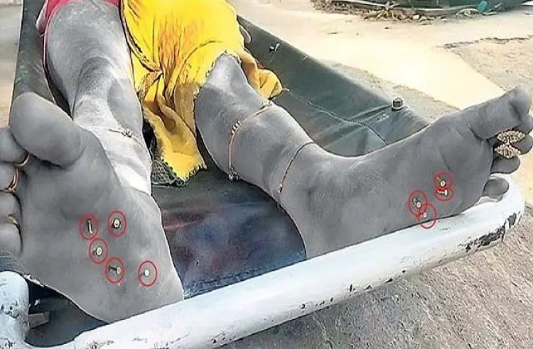 नालंदा में हैवानियत की हद! युवती की बेरहमी से हत्या, पैरों में ठोकी 12 कीलें